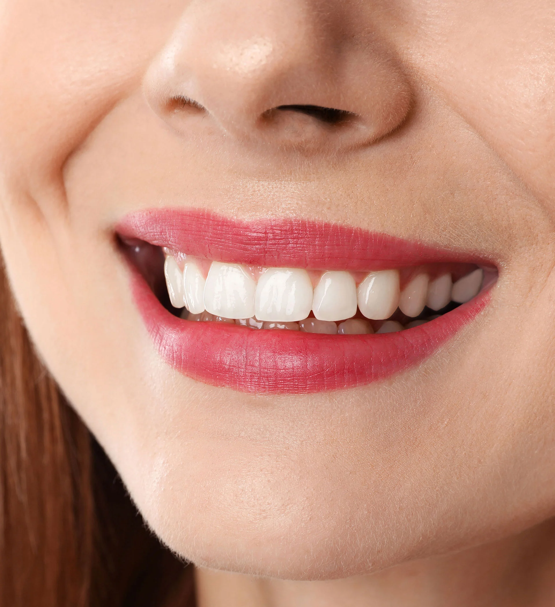 dental-after dental-after