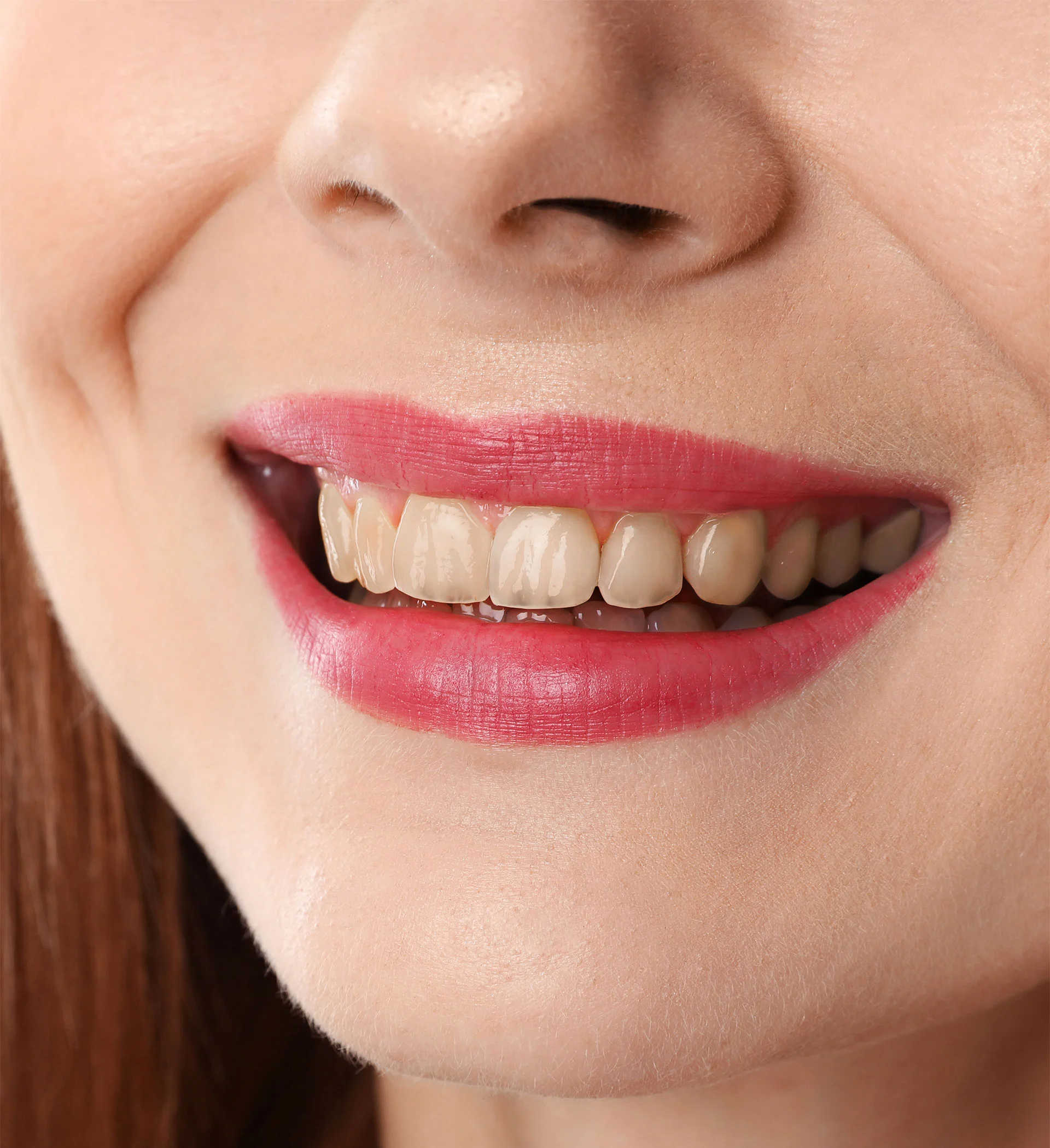 dental-before dental-before