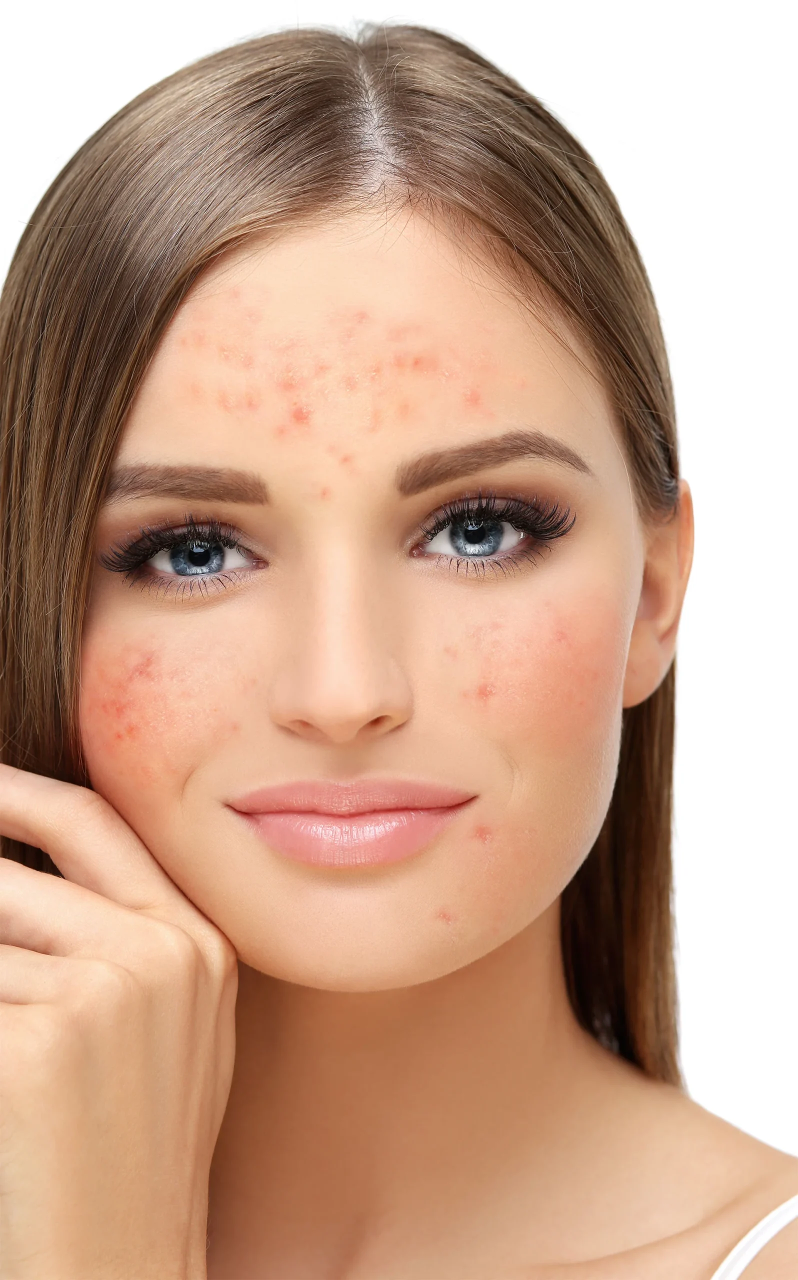 skin-before skin-before